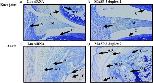 FIGURE 11. Representative histopathology images from the knee joints and ankle of CAIA mice injected s.c. with GalNAc–MASP-3–siRNA duplex 2 or GalNAc–luciferase–siRNA. / The top two panels from left to right (A and B) show staining with T blue (blue color) from the knee joints of CAIA mice treated with GalNAc–luciferase–siRNA (left panel) or with GalNAc–MASP-3–siRNA duplex 2 (right panel). The second set of two panels from left to right (C and D) show staining with T blue from the ankle joints of CAIA mice treated with GalNAc–luciferase–siRNA (left panel) or with GalNAc–MASP-3–siRNA duplex 2 (right panel). Areas of synovium (S, arrow), cartilage (C, arrow), bone marrow (BM, arrow), adipose tissue (AD, arrow), synovial cavity (SCAV, arrow), calcaneus (CA, arrow), talus (T, arrow), and meniscus (M, arrow) are identified. The sections were photographed at original magnification ×20. Scale bars shown in red in the bottom right of each panel for knee joint (A and B), 0.05 mm (50 μm, original magnification ×20), and for ankle (C and D), 0.1 mm (100 μm, original magnification ×10).