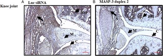 FIGURE 12. Representative C3 deposition images from the knee joints of CAIA mice injected s.c. with GalNAc–MASP-3–siRNA duplex 2 or GalNAc–luciferase–siRNA. / The two panels from left to right (A and B) show IHC C3 staining using anti-C3 Ab (brown color) from the knee joints of CAIA mice treated with GalNAc–luciferase–siRNA (left panel) or with GalNAc–MASP-3–siRNA duplex 2 (right panel). Areas of synovium (S, arrow), cartilage (C, arrow), bone marrow (BM, arrow), and meniscus (M, arrow) are identified. The sections were photographed at original magnification ×20. Scale bar shown in red in the bottom right in (A) and (B) for knee joint, 0.1 mm (100 μm).