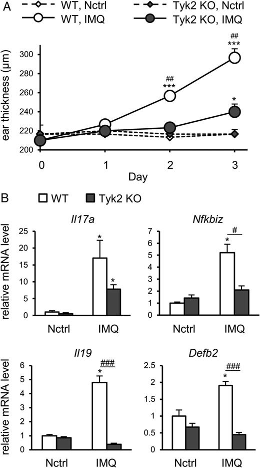 FIGURE 1. TYK2-deficient mice showed reduced inflammation and Nfkbiz expression in IMQ-induced skin inflammation. / (A) Ear skin of WT and Tyk2 knockout (KO) mice was treated with or without IMQ for three consecutive days. Ear swelling was evaluated by a dial thickness gauge on the days indicated. Plots show mean ± SEM of three to four mice per group from three independent experiments. (B) Effect of TYK2 deficiency on mRNA levels of IL-17–related genes (Il17a, Nfkbiz, Il19, and Defb2) in the ear skin 24 h after application of IMQ for three consecutive days. Plots show mean ± SEM of three to four mice per group from three independent experiments. *p < 0.05, ***p < 0.001 compared with negative control (Nctrl); #p < 0.05, ##p < 0.01, ###p < 0.001 compared with Tyk2 KO.