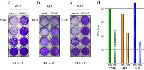 FIGURE 9. Inhibition of viral replication in cells expressing the LY6S-iso1 protein. Human melanoma cells [YDFR-CB3 and M12-CB3, shown in (a) and (c)] or human glioblastoma cells [U87, shown in (b)] as indicated, were stably transfected with an empty expression vector (control) or with an expression vector coding for LY6S-iso1 (LY6S-iso1). VSV was added to the cell cultures, and virus present in the spent medium was assayed on monkey Vero cells, starting with a 100-fold dilution, followed by 10-fold dilutions. Quantitation of the viral titer in the spent medium of the virally infected cultures is shown in (d) (for YDFR cells, at 100-fold dilution, 48-h time point, and multiplicity of infection [MOI] of 0.05; for U87 cells, at 1,000-fold dilution, 48-h time point, and MOI of 0.015; and for M12 cells, at 100-fold dilution, 24-h time point, and MOI of 0.005). The number of viral plaques is indicated in square brackets above the bars for the respective cell types.