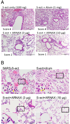 FIGURE 3. Histopathology of alveolar area of the lung in mice treated with Ag + adjuvant. (A) The alveolar regions in the lung specimens (Fig. 2) were enlarged. The different fields were shown with a high magnification under the microscope. Score of leukocyte infiltration was given in each panel as in Iwata-Yoshikawa et al. (14). (B) Representative images of alveoli with eosinophils (arrowheads or asterisks) from Ag + adjuvant-treated mice. Each image represents many fields from a specimen of an individual animal. The insets are higher-magnification images of the boxed area. H&amp;E staining. Scale bars, 50 µm; 20 µm (insets).