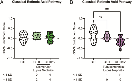 FIGURE 7. Expression of the classical retinoic acid pathway is decreased in class III/IV tubulointerstitial lupus nephritis samples. (A and B) GSVA of the classical retinoic acid pathway gene signature in (A) glomerular and (B) tubulointerstitial lupus nephritis. Significant differences in mean enrichment of the classical retinoic acid pathway gene signature between class II or class III/IV lupus nephritis and control (CTL) were assessed by Brown–Forsythe and Welch ANOVA with Dunnett’s T3 multiple comparisons. Numbers below each lupus nephritis class indicate the number of lupus nephritis patients with enrichment scores &lt;1 SD or &gt;1 SD the CTL mean. The following sample numbers were used: glomerular lupus nephritis (CTL, n = 14; class II, n = 8; class III/IV, n = 22) and tubulointerstitial lupus nephritis (CTL, n = 15; class II, n = 8; class III/IV, n = 22). **p &lt; 0.01.