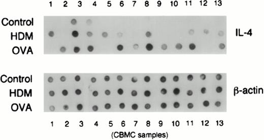 FIGURE 1. Dot blot analysis of IL-4 specific mRNA production in a representative series of CBMC samples stimulated with HDM or OVA allergen. RNA samples from control and stimulated cultures derived from 13 CBMC samples were reverse transcribed, amplified, blotted, and hybridized with a double-stranded probe specific for IL-4 as detailed in Materials and Methods.