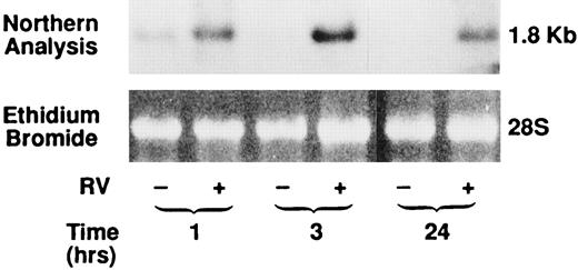 FIGURE 2. Time course of rhinovirus type 9-induced IL-8 mRNA expression in A549 cells. Representative Northern blot analysis of IL-8 mRNA (1.8 kb) in A549 epithelial cells incubated with rhinovirus type 9 (RV) at an MOI of 1. RNA was harvested for analysis at 1, 3, and 24 h. Rhinovirus induced increased expression of IL-8 mRNA in A549 cells, which was clearly visible at 1, 3, and 24 h after inoculation.