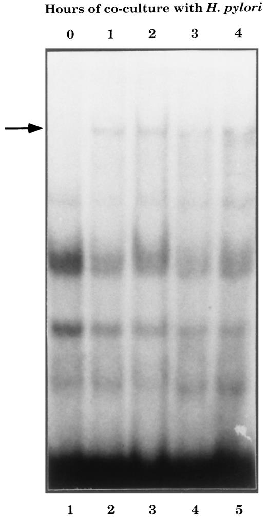 FIGURE 4. A κB binding complex is induced in AGS cells within 1 h of coculture with H. pylori. Nuclear extracts containing equal protein concentrations from AGS cells that were unstimulated or cocultured with H. pylori strain 88-23 were analyzed for κB binding activity by gel-shift assays using an IL-8 κB oligonucleotide as a probe. Lane 1, Nuclear extract from unstimulated AGS cells. Lanes 2 to 5, Nuclear extract from AGS cells cocultured with H. pylori for 1 to 4 h. The arrow indicates the position of the induced κB binding complex.