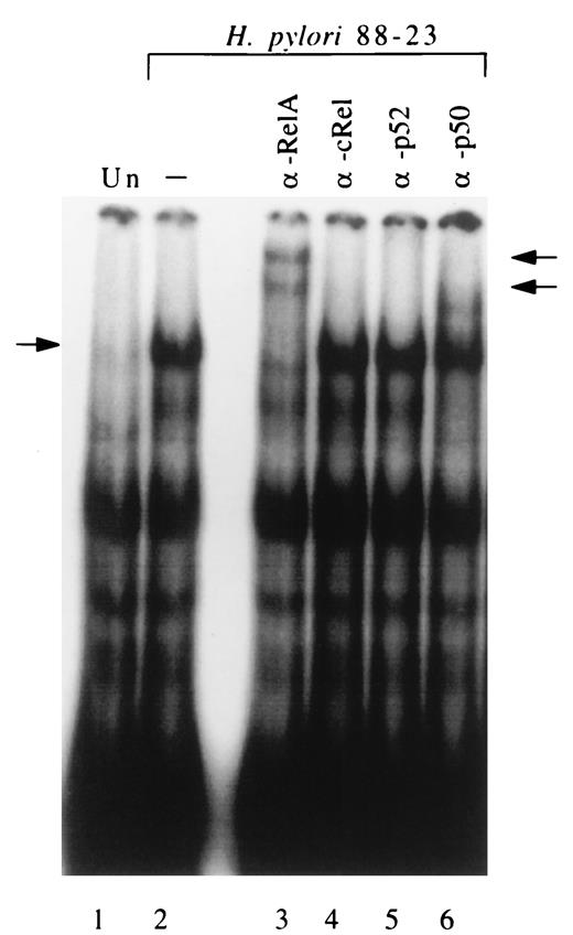 FIGURE 5. Anti-RelA sera recognizes H. pylori-stimulated κB binding complex in nuclear extracts from AGS cells. Nuclear extracts from AGS cells that were unstimulated or cocultured with H. pylori strain 88-23 were analyzed for κB binding by gel-shift assays. The κB probe was incubated with nuclear extracts from AGS cells that were unstimulated (lane 1) or cocultured with H. pylori strain 88-23 (lanes 2–6). The nuclear extracts were preincubated for 30 min with Abs against RelA (lane 3), c-Rel (lane 4), p52 (lane 5), or p50 (lane 6). Arrows indicate the locations of supershifted complexes in lanes 3 and 6.