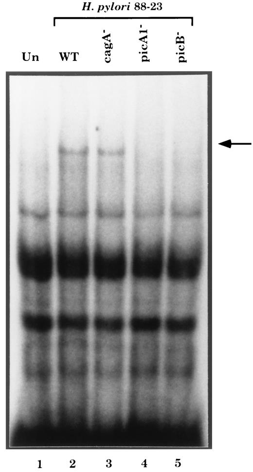 FIGURE 7. The pic gene products of H. pylori are required for induction of NF-κB binding activity in gastric epithelial cells. Equal protein concentrations of nuclear extracts from unstimulated AGS cells (lane 1) and cells cocultured with wt (lane 2), cagA− (lane 3), picA1− (lane 4), or picB− (lane 5) H. pylori strains were analyzed for κB.