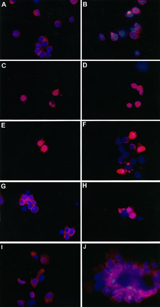 FIGURE 10. NF-AT nuclear translocation in MUC-1-specific CTL in response to MUC1 expressed on tumor cells but not on microspheres. All stimulations shown were performed for 18 h, and the MUC1-specific CTL used were the clonal MA. Allo-specific CTL (A) and MUC1-specific CTL (B) unstimulated; allo-specific CTL (C) and MUC1-specific CTL (D) after ionomycin/phorbol esters; allo-specific CTL (E) and MUC1-specific CTL (F) after T3M4; allo-specific CTL (G) and MUC1-specific CTL (H) after HPAF; MUC1-specific CTL after stimulation with MUC1-conjugated microspheres (I); and MUC1-specific CTL in contact with MUC1-conjugated microspheres (J). NF-AT staining is represented by the red Cy-3 label, and nuclear staining is blue with the Hoechst dye. Cells were observed under oil immersion. Similar results were obtained in another independent experiment.