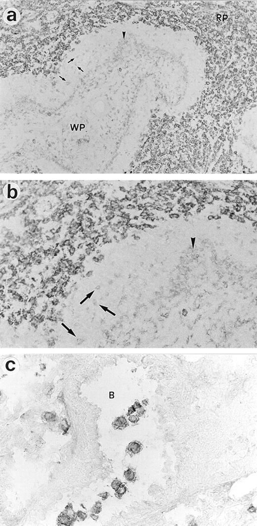 FIGURE 6. Immunohistochemical localization of SIRP in rat spleen at low (a) (×50), or high (b) (×200) magnification, and lung (c) (×400). Frozen sections stained with ED9 using rabbit anti-mouse Ig-peroxidase and DAB/H2O2. Note staining of the various Mφ populations in the spleen, including red pulp Mφ (RP), marginal zone Mφ (arrows), the rim of metalophilic Mφ (arrowhead), and Mφ/DC in the white pulp (WP). Also note strong staining of alveolar Mφ in a lung bronchiole (B).