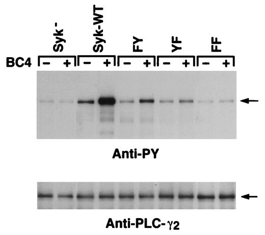 FIGURE 7. FcεRI aggregation-induced tyrosine phosphorylation of PLC-γ2. The parental Syk-negative cells and cells expressing the indicated forms of Syk were either not stimulated (BC4−) or stimulated by mAb BC4 (0.3 μg/ml) (BC4+) for 10 min. Cell lysates were immunoprecipitated with anti-PLC-γ2 Ab. The immunoprecipitated proteins were analyzed by immunoblotting with anti-phosphotyrosine Ab (4G10) and anti-PLC-γ2 Ab. Arrows indicate PLC-γ2.
