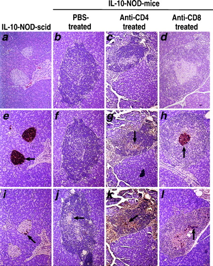 FIGURE 4. Histologic analysis of pancreata from IL-10-NOD-scid (a, e, i), PBS-treated (b, f, j), anti-CD4 mAb-treated (c, g, k), and anti-CD8 mAb-treated (d, h, l) IL-10-NOD mice. The sections were HE-stained. a, Pancreas from IL-10-NOD-scid mouse showing intact islets without any insulitis. b, Pancreas from PBS-treated IL-10-NOD mice showing severe inuslitis. c, Pancreas from anti-CD4 mAb-treated IL-10-NOD mice showing severe inuslitis. d, Pancreas from anti-CD8 mAb-treated IL-10-NOD mice showing severe inuslitis. e, Pancreas from IL-10-NOD-scid mouse, immunostained for insulin using diaminobenzidine as a chromogen. Note the intact islets stained positively for insulin (brown-red color). f, Pancreas from PBS-treated IL-10-NOD mouse. Note the absence of staining for insulin. g, Pancreas from anti-CD4-treated IL-10-NOD mouse. Note that very few cells in the islets stained positively for insulin (brown-red color). h, Pancreas from anti-CD8 treated IL-10-NOD mouse. Note the presence of intact islet stained positively for insulin (brown-red color). i, Pancreas from IL-10-NOD-scid mouse immunostained for glucagon. Note the intact islets stained positively for glucagon (brown-red color). j, Pancreas from PBS-treated IL-10-NOD mouse immunostained for glucagon. Note the brown staining for glucagon as indicated by the arrow. k, Pancreas from anti-CD4-treated IL-10-NOD mouse immunostained for glucagon. Note the brown staining for glucagon as indicated by the arrow. l, Pancreas from anti-CD8-treated IL-10-NOD mouse immunostained for glucagon. Note the brown staining for glucagon as indicated by arrow.