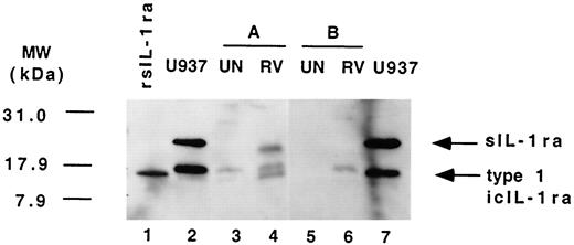 FIGURE 5. Characterization of the isoforms of IL-1ra in human nasal lavage fluids. The IL-1ra moieties in the lavage fluids from uninfected (UN) and RV-infected (RV) volunteers were identified by Western blot analysis. The results obtained with two representative volunteers (volunteer A and volunteer B) are illustrated. The migration of the IL-1ra isoforms in these fluids is compared with the migration of recombinant nonglycosylated sIL-1ra (rsIL-1ra; lane 1) and the glycosylated sIL-1ra and icIL-1ra type I in the lysates from U937 cells (U937; lanes 2 and 7). The sites of migration of glycosylated sIL-1ra (25–26 kDa) and icIL-1ra type 1 (16–17 kDa and 17–18 kDa) are highlighted in the right-hand margin.