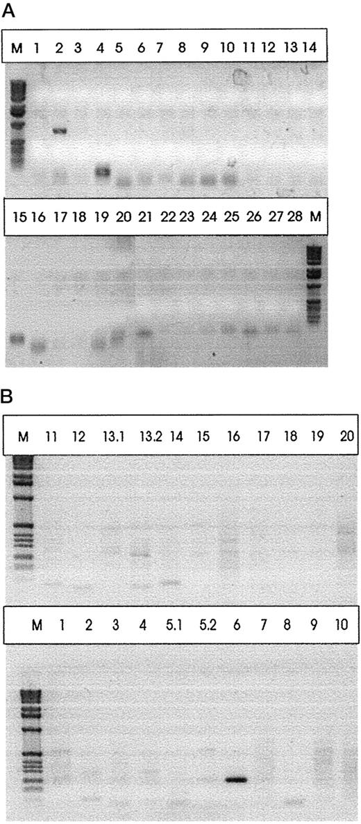 FIGURE 1. Analysis of TCR usage of RT/476-484-specific CTL clone from patient HA. A single dominant PCR product could be detected by agarose gel electrophoresis both for the Vα-chain (Vα2.5; A) as well as for the β-chain (Vβ6; B), demonstrating clonality of the CTL clone.