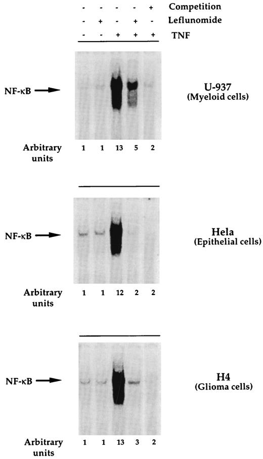 FIGURE 5. Effect of leflunomide on TNF-induced NF-κB in different cell types. U-937, HeLa, or H4 cells (2 × 106/ml) were preincubated for 2 h with or without leflunomide (10 μM), followed by TNF (100 pM) for 30 min. Nuclear extracts were prepared and tested for NF-κB activation as described in Materials and Methods. The specificity of NF-κB binding was determined by performing EMSA in the presence of a 25-fold molar excess of cold NF-κB oligonucleotide.