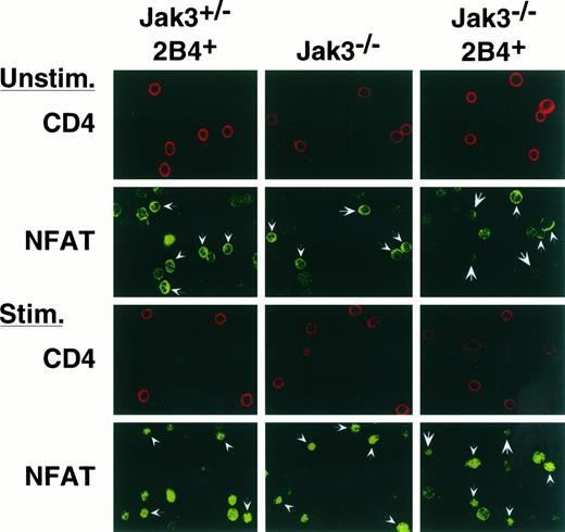 FIGURE 3. Intact nuclear translocation of NF-AT1 in both activated and naive/resting Jak3−/− CD4+ T cells. Splenocytes from 2B4 TCR transgenic Jak3+/−, nontransgenic Jak3−/−, and 2B4 TCR transgenic Jak3−/− mice were allowed to attach to coverslips and were either left unstimulated (Unstim.) or were stimulated with PMA plus ionomycin (Stim.) for 5 min. Fixed cells were permeabilized and stained for CD4 and NF-AT1. CD4 and NF-AT1 stainings were detected in the same fields by their red and green fluorescence, respectively, using confocal microscopy. The arrows in the NF-AT1 panels point to CD4-positive cells. For the Jak3−/− 2B4+ splenocytes, small and large arrows indicate CD4-positive cells fluorescing with bright and dull intensities, respectively. The Jak3−/− 2B4+ animal used for this experiment contained 30–40% naive/resting CD4+ T cells as measured by flow cytometry (data not shown).