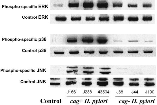 FIGURE 4. cag+ and cag− H. pylori strains demonstrate a consistent pattern of differential MAP kinase activation. AGS monolayers were cultured alone (Control) or were infected with one of three H. pylori cag+ strains (108 bacteria/ml; lane 2, J166; lane 3, J238; lane 4, 43504) or with one of three H. pylori cag− clinical isolates (108 bacteria/ml; lane 6, J68; lane 7, J44; lane 8, J190). After 1 h of incubation, cell lysates were prepared and then subjected to Western blot analyses using phospho-specific MAP kinase Abs (upper panels). Western blots performed using control Abs that recognize ERK, p38, or JNK regardless of their phosphorylation states are shown (lower panels). These experiments were performed on three occasions, and a representative blot is shown.
