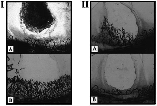 FIGURE 2. Rat CMP assay of lung tissue angiogenic activity. IA, Representative cornea (n = 6) angiogenic response from saline-treated lungs on day 12 after intratracheal saline administration (day 0). IB, Representative cornea (n = 6) angiogenic response on day 12 after intratracheal bleomycin (0.025 U) administration (day 0). n = 6 lungs in each group. IIA, Representative cornea (n = 6) angiogenic response on day 12 after intratracheal bleomycin (0.025 U) administration (day 0) from mice administered 20 μl of 0.25% HSA (control) i.m. every 24 h. IIB, Representative cornea (n = 6) angiogenic response on day 12 after intratracheal bleomycin (0.025 U) administration (day 0) from mice treated with 1 μg of IP-10 in 20 μl of 0.25% HSA by i.m injection every 24 h.