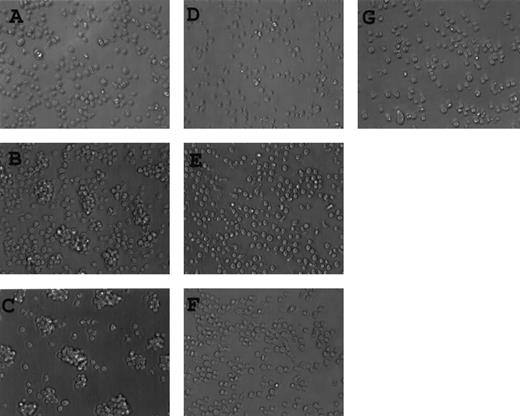 FIGURE 6. Induction of homotypic aggregation in E10.2.3 by DMF10.62.3. E710.2.3 cells were treated with DMF10.62.3 at 1 μg/ml (A), 5 μg/ml (B), or 15 μg/ml (C); with hamster IgG at 1 μg/ml (D), 5 μg/ml (E), or 15 μg/ml (F); or with medium alone (G) for 6 h and then photographed. Data are representative of three independent experiments.