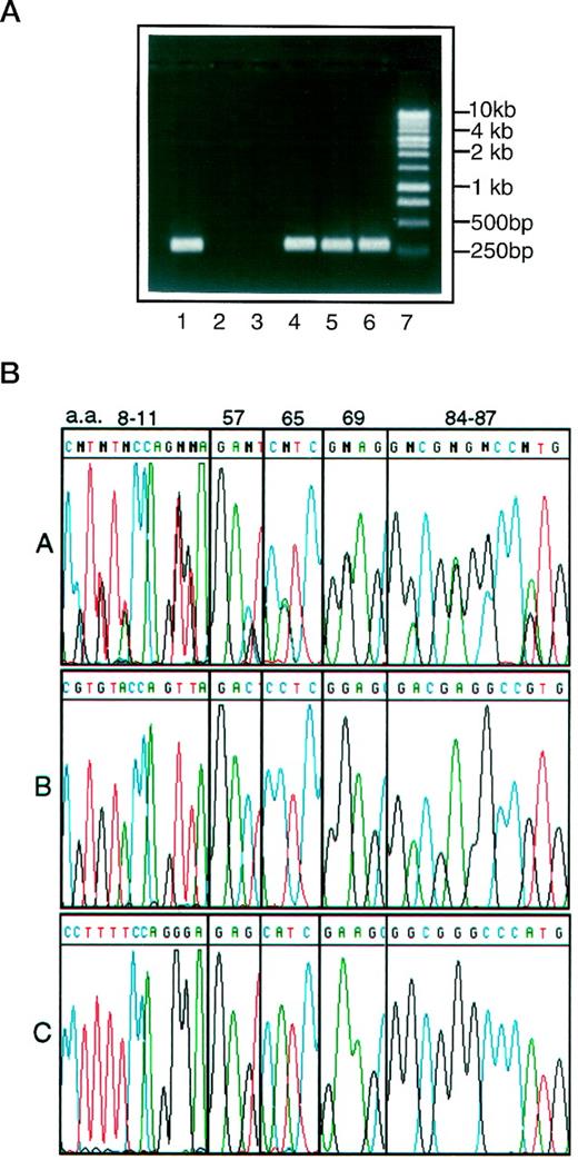 FIGURE 1. A, Group-specific amplification of exon 2 of the HLA-DPB1 gene from three samples carrying different DNA sequences at the aa positions 84–87. Sample A (lanes 1 and 2) carries GGC GGG CCC ATG at positions 84–87. Sample B (lanes 3 and 4) carries GAC GAG GCC GTG. Sample C (lanes 5 and 6) carries both. A generic 5′ primer, UG19, was used for all lanes. Two group-specific 3′ primer (13 ) Gly84R (complementary to sample A) and Asp84R (complementary to sample B) were used for odd lanes and even lanes, respectively. Lane 7 is 1-kb ladder DNA size marker (Promega, Madison, WI). B, Automated DNA sequencing of PCR products amplified separately with three different 3′ primers from a DNA sample (sample C shown in A) carrying heterozygous DNA sequences at positions 84–87. A generic 5′ primer, UG19, was used for PCR in combination with a generic 3′ primer UG21 (A), a group-specific 3′ primer Asp84R (B), and another group-specific 3′ primer Gly84R (C). All sequencing reactions were performed in the presence of the generic 5′ primer UG19. All the polymorphic sites in A, which is a sequencing result of PCR products amplified by two generic primers at both 5′ (UG19) and 3′ (UG21) ends, were completely separated by group-specific PCR amplification shown in B and C.