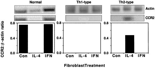 FIGURE 3. CCR2 and β-actin mRNA levels in normal (A), Th1-type (B), and Th2-type (C) fibroblasts. All three fibroblast types were seeded at identical densities in six-well tissue culture plates and treated as described in Materials and Methods. Depicted is a representative ethidium bromide-stained gel showing RT-PCR gel comparing β-actin and CCR2. The ratio of CCR2:β-actin expression is shown immediately below each panel and is representative of three similar experiments.