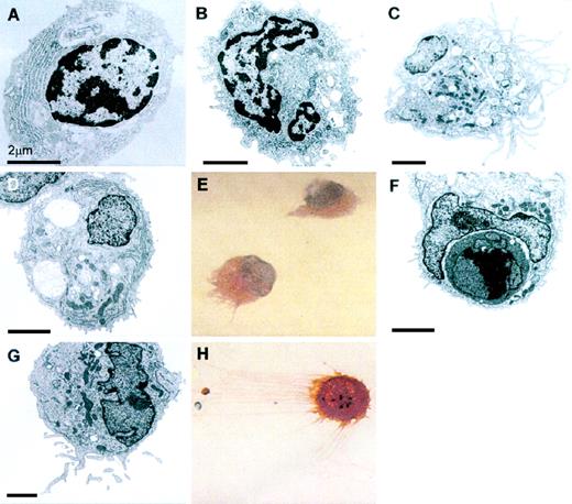 FIGURE 3. EM and immunohistochemical analyses of freshly isolated and cytokine-stimulated PB-DC subsets. A, Freshly isolated CD11c− PB-DC display a plasmacytoid phenotype. Note the prominently developed ER of these cells and their even, nonruffled plasma membrane. B, Freshly isolated CD11c+ PB-DC fail to display the prominent ER membranes of their CD11c− counterparts. Unlike the CD11c− DC type, these cells have indented nuclei and ruffled surfaces. C, Two-day GM-CSF/IL-4-stimulated CD11c+ DC display numerous delicate dendritic membrane projections and macropinosome-like vesicles. D and E, In the presence of neutralizing anti-TNF-α mAbs, IL-3-stimulated CD11c− DC survive, but maintain their plasmacytoid phenotype. The persistence of abundant ER membranes and the paucity of dendritic membrane projections in IL-3/anti-TNF-α-treated CD11c− DC are shown by EM (D) and anti-HLA-DR immunohistochemistry of cytospin preparations (E). F, IL-3/anti-TNF-α-treated CD11c− DC can take up nuclei from apoptotic cells. G and H, Note the lack of abundant ER membrane by EM (G) and the appearance of delicate long and anti-HLA-DR-reactive plasma membrane projections in IL-3/TNF-α-stimulated CD11c− DC (H). Bars denote 2 μm.