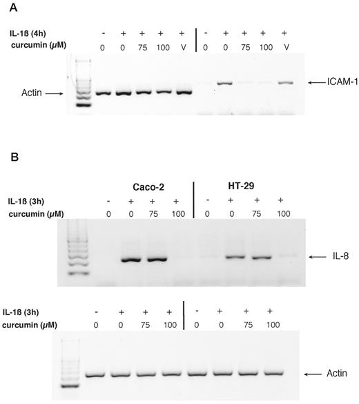 FIGURE 1. Inhibition of ICAM-1 (A) and IL-8 (B) gene expression by curcumin in IEC-6, Caco-2, and HT-29 cells as measured by RT-PCR. Cells were pretreated with curcumin (75 and 100 μM), vehicle (V; 0.5% ethanol), or medium alone for 45 min and then stimulated with IL-1β (2 ng/ml) or medium alone for 4 h. Total RNA was extracted, reverse transcribed, and amplified using specific ICAM-1 (A), IL-8 (B), or actin primers. PCR products were run on a 2% agarose gel and stained with gel Star. These results are representative of two different experiments.