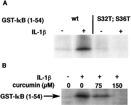FIGURE 9. Curcumin inhibits IL-1β-induced IKK activity in Caco-2 cells. A, Cells were stimulated for 20 min with IL-1β (2 ng/ml) or medium alone. Cells were lysed and IKKα immunoprecipitated, and kinase activity was measured using a GST-IκB (wt; 4 μg) substrate or a mutated form of GST-IκBα (S32T; S36T) as described in Materials and Methods. Phosphorylated GST-IκBα was visualized after protein fractionation using 12.5% SDS-PAGE. Coomassie staining was used to document equal protein loading (not shown). B, Cells were pretreated with curcumin (75 and 150 μM) or with medium alone for 45 min and then stimulated with IL-1β (2 ng/ml) for 20 min. Cells were lysed, and IKK activity was measured as described above. Results are representative of two independent experiments.