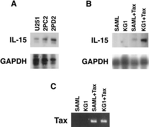 FIGURE 5. A, RPA performed on the RNA isolated from two astrocytic cell lines, 2PC2 and 2PD2, transfected stably with a Tax construct and their parental cell line U251 using IL-15 and GAPDH probes. The intensity of the IL-15 band was determined to be 2.1-fold with 2PC2 and 3.6-fold with 2PD2 greater than that of the U251, as determined by phosphoimager densitometry. B, IL-15 mRNA was detected by RPA in two monocytic cell lines, KG1 and SAML, only after transient transfection of a Tax construct into these cells. C, Expression of Tax plasmid was confirmed by conducting an RT-PCR experiment on KG1 and SAML cells before and after HTLV-I Tax construct transfection. Tax cDNA was amplified only in cells after transfection of the Tax construct.