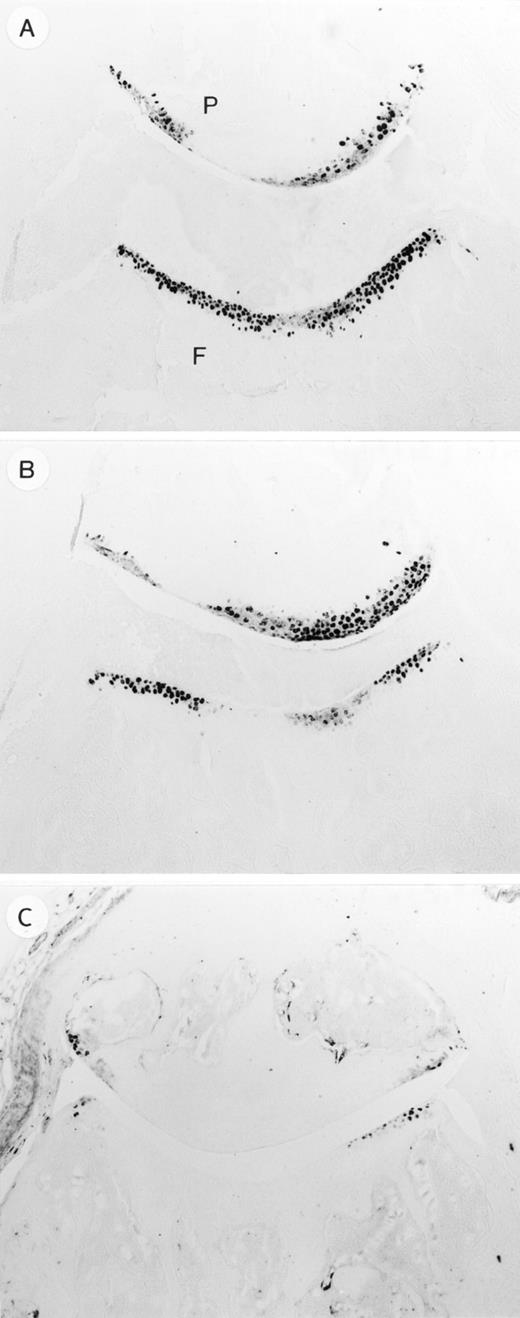 FIGURE 7. Expression of cartilage proteoglycan breakdown neoepitope VDIPEN. Fully affected cartilage in control rabbit Ig (A) and sTNFbp (B) treated animals. Note the marginal expression of VDIPEN in cartilage of anti-IL-1α+β-exposed mice. C, VDIPEN expression was determined at day 36. No difference was found in VDIPEN expression between the two control groups, BSA and rabbit Ig. P = patella, F = femur. Original magnification ×100.