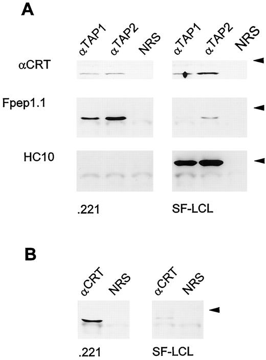 FIGURE 9. Association of HLA-F with TAP and calreticulin. A, Immunoblot of proteins coprecipitated from digitonin lysates of .221 and SF-LCL cells by rabbit antisera against TAP1 (αTAP1) and TAP2 (αTAP2), and by normal rabbit serum (NRS). Coprecipitated proteins were immunoblotted with an antiserum to calreticulin (αCRT) and with mAb Fpep1.1 and HC10. Precipitating and immunoblotting Ab are indicated at the top and left-hand side, respectively. The positions of the 66-kDa (αCRT panel) and 45-kDa (Fpep1.1 and HC10 panels) marker proteins, respectively, are indicated at the right. B, Immunoblot of proteins coprecipitated from Triton X-100 lysates of .221 and SF-LCL by an antiserum to calreticulin (αCRT) and by normal rabbit serum (NRS). Coprecipitated proteins were immunoblotted with Fpep1.1. The position of the 45-kDa marker protein is indicated by the arrow. In both A and B, coprecipitated proteins were separated on an 8% polyacrylamide gel. Anti-CRT binding was detected using biotin-conjugated protein G and StreptABComplex/ HRP, and Fpep1.1 and HC10 binding was detected using HRP-conjugated rabbit anti-mouse IgG. Immunoblots were developed using the ECL system.