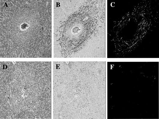 FIGURE 9. Photomicrographs of granulomas from type 1 and type 2 polarized mice. Serial liver sections were prepared from infected IL-10/IL-12-deficient (A–C) and IL-10/IL-4-deficient (D–F) mice and stained with either Giemsa (A and D) or the collagen-specific stain picrosirius red (B, C, E, and F). Picosirius red-stained sections were viewed with a Leica DMLB microscope (Rockleigh, NJ) under both bright (B and E) and plane-polarized light illumination (C and F). All sections were viewed at ×40 magnification.