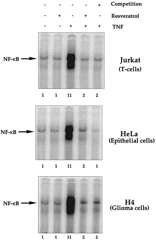 FIGURE 4. Effect of resveratrol on activation of NF-κB induced by TNF in different cell lines. Jurkat, HeLa, and H4 cells (2 × 106/ml) were incubated at 37°C with 5 μM resveratrol for 4 h and then treated at 37°C for 30 min with 100 pM TNF. After these treatments, nuclear extracts were prepared and then assayed for NF-κB.