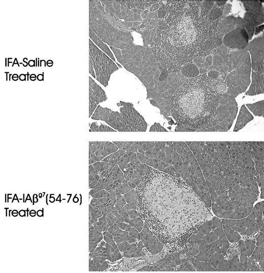 FIGURE 9. Histology of the pancreas from an NOD mouse treated with I-Aβg7(54–76) peptide or saline emulsified in IFA. Pancreatic tissue sections were stained with hematoxylin and eosin. Pancreatic sections from saline-treated mice show heavy infiltration and destruction of islets. Sections of pancreas from peptide-treated mice show confined periinsulitis with no destruction of islet cells.