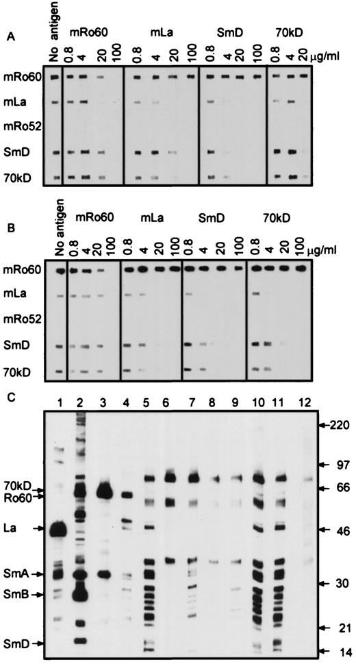 FIGURE 5. Competitive inhibition of binding of sera from SJL mice immunized with peptide hRo60316–335 to recombinant proteins in slot blot (A) and cell extracts in Western blot (C). B, Represents sera from mice immunized with the mouse peptide in slot blots. Pooled sera at 1/500 dilution were preincubated with increasing amounts of recombinant proteins, and used in slot blot or Western blot analysis. C, Lanes 1–3, Human antisera reactive with La, Sm, and RNP. Lane 4, Pooled serum from mice immunized with mrRo60. Lanes 5–11, Pooled serum from mice immunized with peptide. Lanes 5 and 11, Unabsorbed sera. Sera preincubated with Ro60 (lane 6), La (lane 7), SmD (lane 8), 70-kDa U1RNP (lane 9), and GST (lane 10). Lane 12, Represents age-matched pooled serum from mice immunized with control peptide JS7A (zona pellucida peptide).
