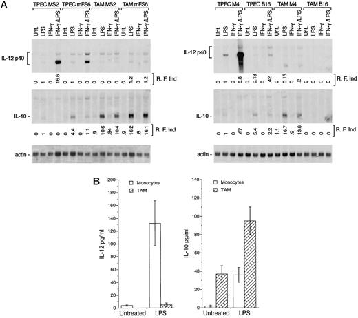 FIGURE 4. A, Expression of IL-12 and IL-10 mRNAs in TAM from different murine tumors. Ten micrograms of total RNAs from TAM and TPEC treated as indicated for 4 h was analyzed by Northern blot for IL-12 p40 and IL-10 mRNA expression. In each group, 10 mice were injected with the following tumors, as indicated: Moloney sarcoma virus-derived MS2, the benzo(a)pyrene-induced mFS6 sarcoma, and its derived M4 subline, the B16 melanoma. R. F. ind., relative fold induction. Values were normalized for the levels of mRNA expression observed in LPS-stimulated TPEC MS2 (left) or LPS-stimulated TPEC M4 (right), to which a value of 1.0 was assigned. B, Defective IL-12 production and high secretion of IL-10 in TAM from human ovarian carcinoma. IL-12 and IL-10 proteins were determined by ELISA. Three different experiments are considered and results are expressed as pg/ml ± SD.