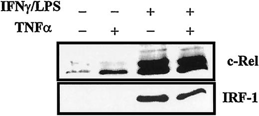 FIGURE 8. Nuclear translocation of NF-κB c-Rel and IRF-1. Nuclear extracts were prepared as described in Fig. 6. Six micrograms of nuclear proteins for each condition was applied to a 15% SDS-PAGE under reducing conditions. After electrophoresis, the gel was electrophoretically blotted to a nitrocellulose membrane and hybridized to Abs of interests, visualized using the enhanced chemiluminescence detection reagents (Amersham). One of two independent experiments with highly similar results is shown.