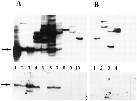 FIGURE 4. Demonstration of the Vα24+ TCR rearrangement and the invariant Vα24JαQ TCR in biopsied peripheral nerves. In this experiment, 10 sural nerve samples from CIDP patients (A) and 4 from ONDs (B) were examined on the same SSCP gel. The same patient codes are used in this figure and Table IV. The arrows indicate the position for the invariant Vα24JαQ band.