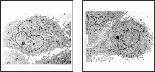 FIGURE 1. Morphological appearance at electron microscopy of D3-DC and Ctr-DC. DC were differentiated from monocytes cultured for 7 days in GM-CSF (50 ng/ml) and IL-4 (10 ng/ml) in the absence (left) or the presence (right) of 1α,25-(OH)2D3 (10 nM).