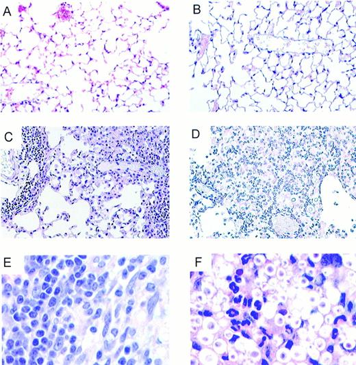 FIGURE 4. Lung pathology in MIP-1α+/+ and MIP-1α−/− mice infected with C. neoformans weeks 3 and 4 postinfection (hematoxylin and eosin). A, Uninfected MIP-1α+/+ mice lung (magnification, ×66). B, Uninfected MIP-1α−/− mice lung (magnification, ×66). C, Lungs of C. neoformans-infected MIP-1α+/+ mice at week 3 (magnification, ×132). Note the massive leukocyte infiltrate with predominantly mononuclear cells and only a few cryptococci on the histological section. D, Lungs of C. neoformans-infected MIP-1α−/− mice at week 3 (magnification, ×132). Note massive eosinophil infiltrates surrounding numerous highly encapsulated cryptococci. E, Lungs of C. neoformans-infected MIP-1α+/+ mice at week 4 (magnification, ×330). Note the massive mononuclear cell infiltrate and few cryptococci. F, Eosinophils infiltrating area of the lung of MIP-1α−/− mice infected with cryptococci at week 4 (magnification, ×330). Note the numerous cryptococci and their large capsules.