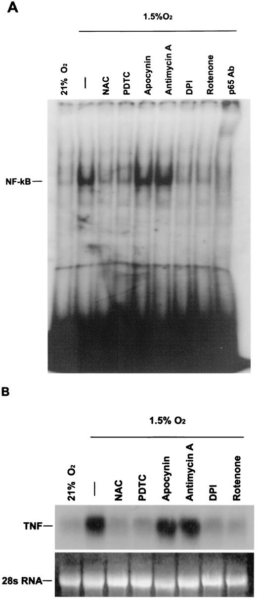FIGURE 6. A, NF-κB DNA-binding activity in nuclear extracts from J774.1 cells exposed to hypoxia (1.5% O2) in the presence of the antioxidants NAC (500 μM) and PDTC (10 μM), apocynin (300 μM), antimycin (1 μg/ml), DPI (10 μM) and rotenone (1 μg/ml), for 2 h. B, Northern blot analysis of TNF-α mRNA levels from J774.1 cells exposed to hypoxia (1.5% O2) in the presence of the antioxidants NAC (500 μM) and PDTC (10 μM), apocynin (300 μM), antimycin (1 μg/ml), DPI (10 μM), and rotenone (1 μg/ml) for 6 h.