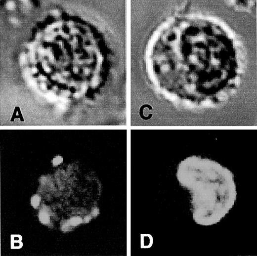 FIGURE 7. After alkalization of endosomes and lysosomes, QC is redistributed from cytoplasmic vacuoles to the nucleus. PBMC adherent to glass slides were preincubated in the absence (A and B) or presence (C and D) of bafilomycin A1 (100 nM) before addition of QC (1 μM). Figure shows both the bright field (A and C) and fluorescent (B and D) images of individual cells.
