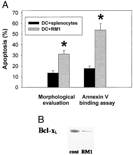 FIGURE 1. Prostate cancer cells induced apoptotic death of DC, which was mediated by decreased expression of the anti-apoptotic protein Bcl-xL. Coincubation of RM-1 tumor cells with cultured bone marrow-derived DC resulted in significantly increased levels of death of DC as assessed by morphological analysis and annexin V binding assay. A, DC were coincubated with RM-1 tumor cells separated through a 0.4-μm pore size membrane for 48 h, harvested, cytospan, and evaluated for apoptosis based on morphological criteria, which included condensation of cytoplasm and nuclei, degranulation, shrinkage of cytoplasm, and formation of apoptotic bodies. Splenocytes and tumor medium, used instead of tumor cells, served as controls. Annexin V binding was performed as described in Materials and Methods. As shown, RM-1 cells caused significantly higher levels of DC apoptosis compared with splenocytes, which was confirmed by both morphologic evaluation and annexin V assay. Data are shown as the mean ± SEM. Three independent experiments were performed with similar results, and combined data are presented. B, The results of Western blot analysis suggested that the coincubation of cultured bone marrow-derived DC with RM-1 cells for 48 h caused the marked decrease in expression of Bcl-xL protein in DC compared with that in control DC. ∗, p < 0.001.