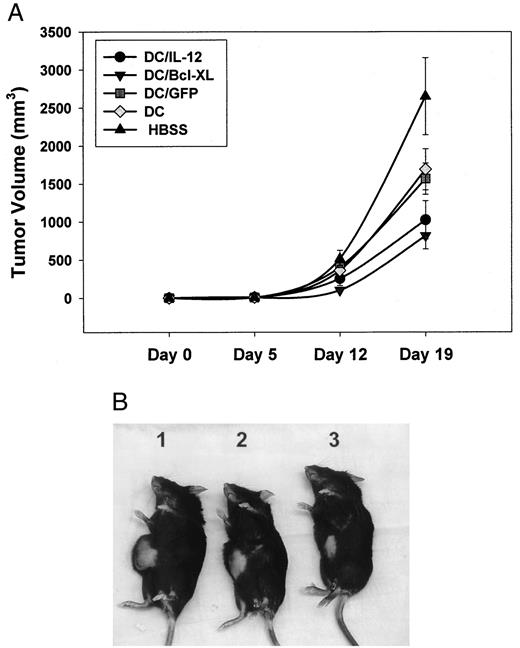 FIGURE 7. Intratumoral administration of IL-12- or Bcl-xL-transduced DC resulted in significant inhibition of tumor growth in vivo. Murine PCa cells were injected in mice as described in Materials and Methods. Nontransduced DC, transduced DC, or HBSS were injected at the tumor site in a volume of 50 μl, and the tumor sizes were recorded twice per week. A, Treatment with nontransfected or GFP-transfected DC had a significant effect on tumor growth compared with HBSS administration. Treatment of PCa-bearing mice with IL-12- or Bcl-xL-transfected DC resulted in significant inhibition of tumor growth compared with that in mice treated with HBSS, nontransfected DC, or GFT-transfected DC (p < 0.05). Data represent the mean ± SEM from three independent experiments. B, Representative examples of PCa-bearing mice sacrificed on day 20. An HBSS-treated mouse (1) exhibits the largest size of RM-1 tumor, a nontransfected DC-treated mouse has a smaller tumor (2), and a mouse treated with Bcl-xL-transfected DC bears the smallest tumor (3).