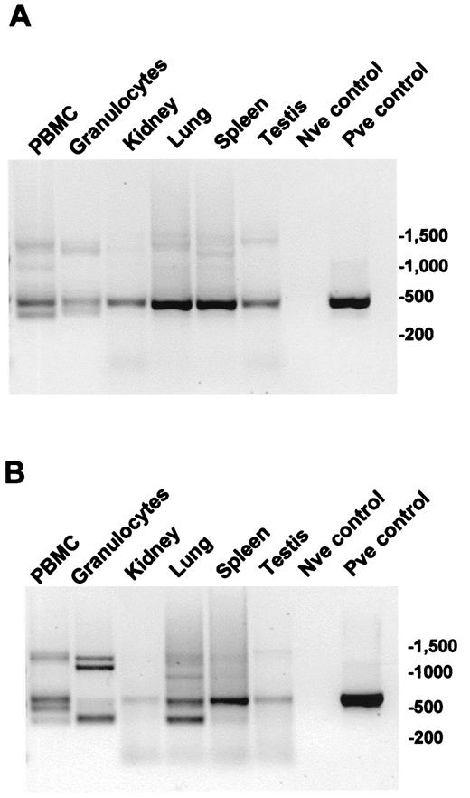 FIGURE 4. RT-PCR analysis of pig DAF isoforms in tissues. Primer pairs, shown in Fig. 1, were chosen either to specifically amplify the transmembrane isoforms of pig DAF (A) or to amplify all isoforms (B). Equal volumes of all PCR products were loaded on the agarose gel and separated as described. The multiple products obtained are apparent in the gel images. Plasmid containing full-length pDAFtm was used as positive (Pve) control for the RT-PCR. Empty plasmid was used as negative (Nve) control. Size markers are shown on the right in each panel.