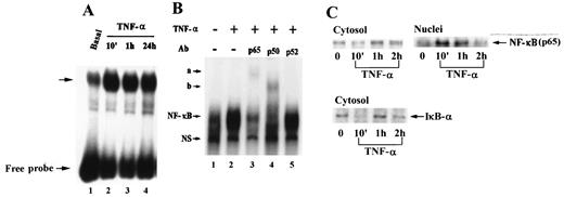 FIGURE 10. Kinetics of TNF-α-induced NF-κB-specific DNA-protein complex formation, NF-κB translocation, and I-κB-α degradation in NCI-H292 epithelial cells. Cells were treated with 30 ng/ml of TNF-α for 10 min, 1 h, or 24 h (A), then cytosolic and nuclear extracts were prepared. In A, NF-κB-specific DNA-protein-binding activity in nuclear extracts was determined by EMSA, as described in Materials and Methods. In B, supershift assays were performed using 2 μg of the indicated Abs, as described in Materials and Methods. In C, cytosolic and nuclear levels of NF-κB (p65) proteins and cytosolic levels of I-κB-α were immunodetected using specific Ab, as described in Materials and Methods.
