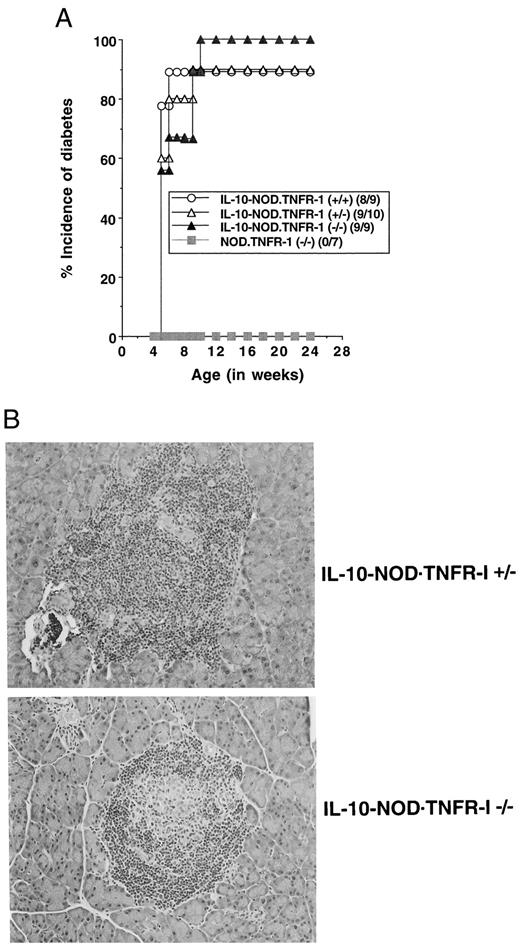 FIGURE 4. A, Incidence of autoimmune diabetes in IL-10-NOD. TNFR-1-deficient (−/−) and sufficient (+/−, +/+) mice. Their non-tg TNFR-1-deficient (−/−) littermate controls are also included. The mice used were of the N3-N4 backcross generations. B, H&E staining of paraffin-embedded pancreatic sections from diabetic IL-10-NOD. TNFR-1-deficient (−/−) and sufficient (+/−) mice, respectively (×200).