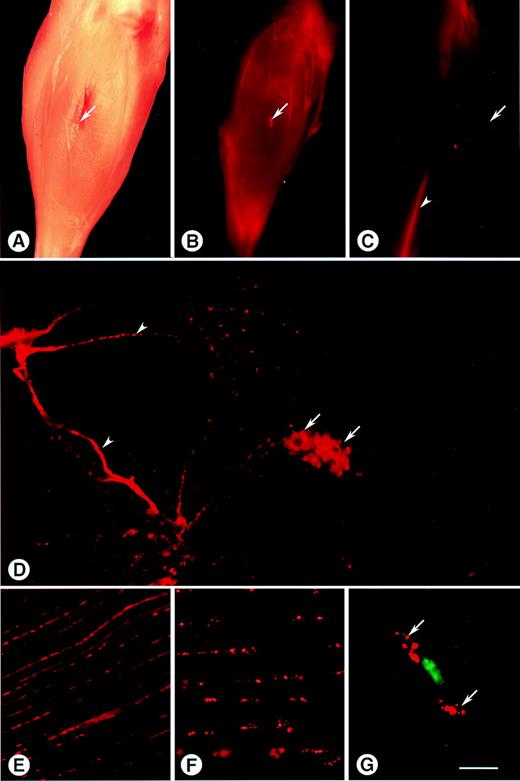 FIGURE 1. Distribution of labeled DNA in muscle after i.m. injection. A–C, Micrographs of the tibialis anterior muscle. The site of injection is shown (arrow) A, Bright field micrograph showing orientation of the lower leg. B, Fluorescence micrograph of the lower leg showing the localization of rhodamine-labeled DNA (red) 5 min after injection into the muscle. C, Fluorescence micrograph showing a lateral view of the muscle 5 min after injection. The accumulation of rhodamine-labeled DNA is conspicuous along the myotendinous junction of the tibialis anterior (arrowhead). D, Fluorescence micrograph of a Vibratome transverse section (150 μm) of the tibialis anterior muscle 5 min after injection. Rhodamine-labeled DNA localization between muscle cells (arrowheads) and inside muscle cells (arrows) is conspicuous. E, Fluorescence micrograph of a Vibratome section of the tibialis anterior muscle cut longitudinally 5 min after injection. Most of the rhodamine-labeled DNA located between the muscle fibers is extracellular. F, Fluorescence micrograph of a Vibratome section of the tibialis anterior muscle cut longitudinally 24 h after injection. Most of the rhodamine-labeled DNA located between the muscle fibers is inside non-muscle cells. G, Confocal micrograph showing rhodamine-labeled DNA (red) inside small cytoplasmic vesicles (arrows) of mononuclear cells located between muscle fibers. Nuclear staining (green) in fixed tissue with 1 μM YO-PRO-1. Scale bar: A–C, 2 mm; D, 500 μm; E–F, 50 μm; G, 5 μm.