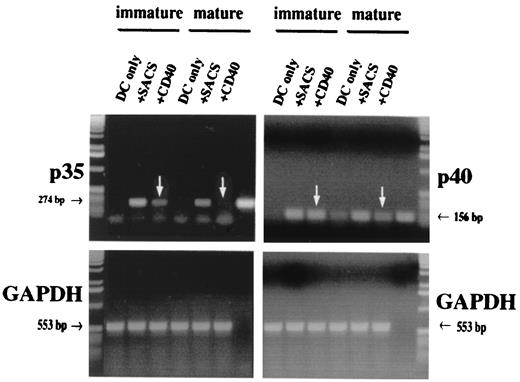 FIGURE 7. Immature dendritic cells stimulated by ligation of CD40 express more mRNA for both IL-12 chains than mature dendritic cells. Dendritic cells were cultured in the presence or absence of MCM from day 7 to day 10. The resulting mature and immature populations, respectively, were plated at 1 × 106 cells/ml in the presence or absence of CD40 ligand-expressing cells and SACS for another 18 h, and cell lysates were subjected to PCR analyses. Note that both the mRNAs for p35 (40 cycles; left) and p40 (35 cycles; right) are up-regulated in response to the stimuli applied (compare with “DC only”). mRNA levels in response to CD40 ligation are higher in immature than in mature dendritic cells (compare arrowed lanes). Positive control, top panels, far right lanes.