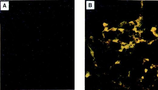 FIGURE 5. Localization of DAPI-labeled, irradiated, and OVA-pulsed lung cells examined by fluorescence microscopy 2 days after adoptive transfer to recipient mice. A, Transferred lung cells not cultured with DAPI. B, Transferred lung cells cultured with DAPI (×200 magnification).