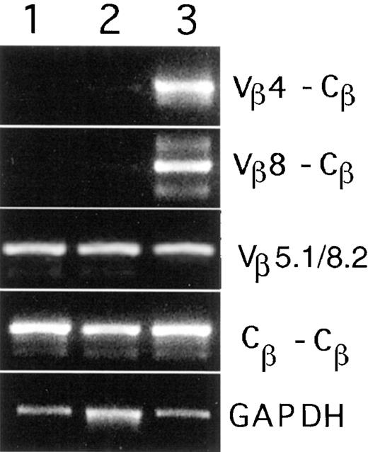 FIGURE 1. Detection of TCR Vβ germline transcription in Rag2−/− and SCID thymocytes. Total RNA samples from 1) Rag2−/−, 2) SCID, and 3) B6 thymocytes were used for RT-PCR analysis. PCR primer pairs Vβ4-Cβ and Vβ8-Cβ were used to detect transcription of rearranged TCR genes. Primer pairs Vβ5.1/8.2 and Cβ-Cβ were used to detect transcription of the TCR Vβ 8.2 and TCR Cβ regions, respectively, from both germline and rearranged genes. GAPDH was used as a control to normalize sample variations.